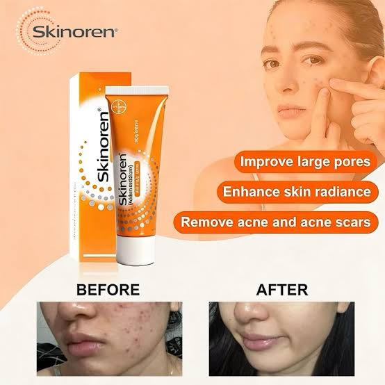 Skinoren azelic acid Cream