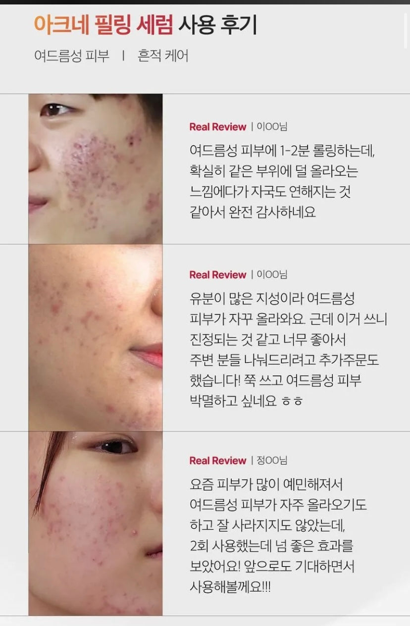 medicube - Red Acne Succinic Acid Peel
