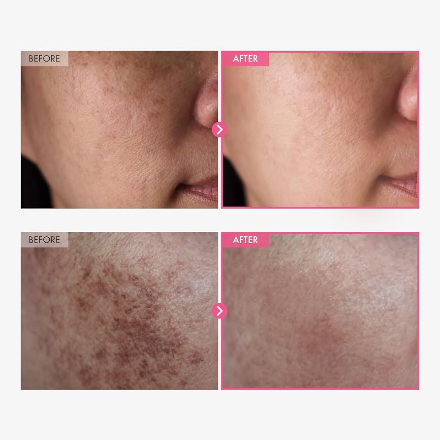 Tosowong Alpha Arbutin Cream 7%