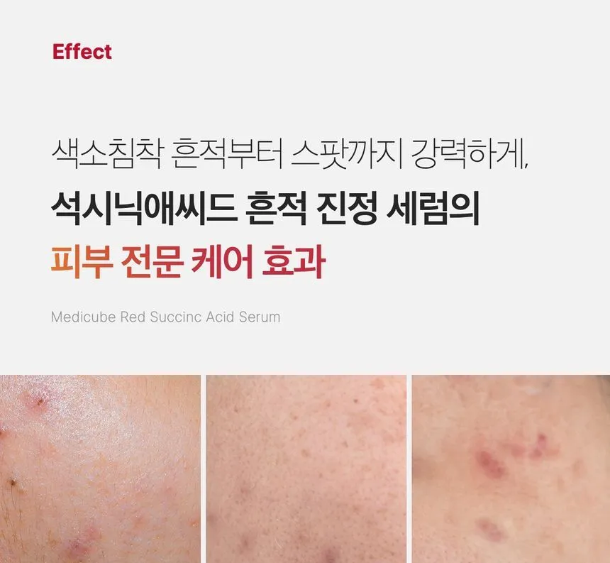 Medicube - Red Succinic Acid Serum - Image 4