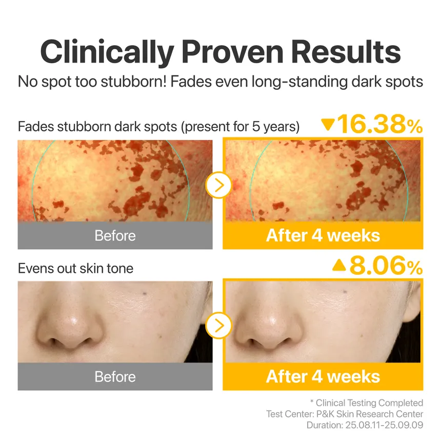 numbuzin - No.5 Glutathione TXA Advanced Dark Spot Ampoule Concentrate - Image 4