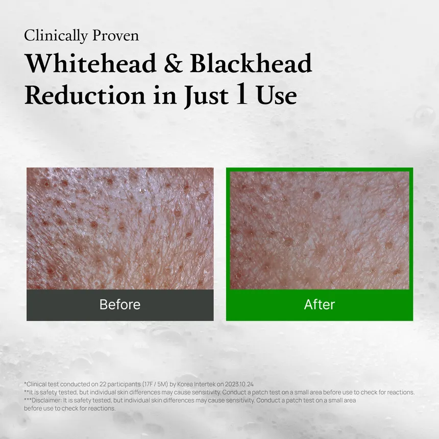 FULLY - Green Tomato Clay Pack Cleanser Mini - Image 4